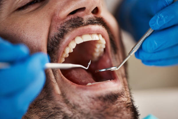 Best Emergency Gum Pain Relief  in Wyong, MI